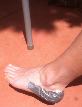 Elke's duct taped foot low-res 986